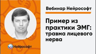 Пример из практики ЭМГ: травма лицевого нерва | Вебинар Нейрософт