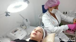 Peeling Diamantado Facial / Vitamina C