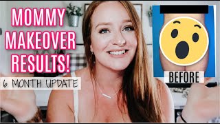 MOMMY MAKEOVER SURGERY | 6 MONTH POST OP RESULTS | BEFORE & AFTER