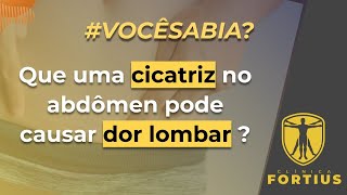 Cicatriz no abdômen pode causar dor lombar ou nas costas!