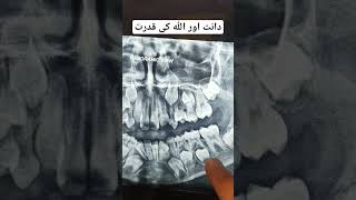 Allah ki Qudrat #allah #nabi #quran #hadees #teeth #dentist