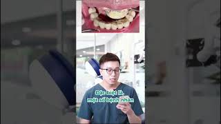 Cao răng MƯNG MỦ 🤢🤢🤢