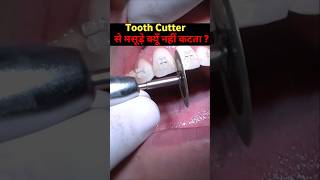 Tooth Cutter से मसूड़े क्यूँ नहीं कटता है? #shortvideo #youtubeshorts #viralvideo