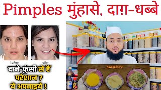 आज के बाद कभी चेहरे पे फुनसि नी निकलेगी || 3 Cheeze Ghar Me Bana Lo || 🙂 Maulana Farman Nasim