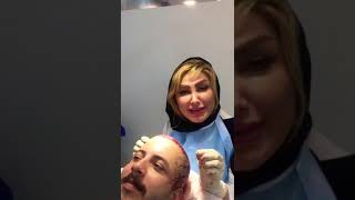 زرع شعر بإيران إعلان للعراق جربوا زراعة الشعر مع دكتورة إيرانية أجمل زراعة لا تنسى الاشتراك ارتا