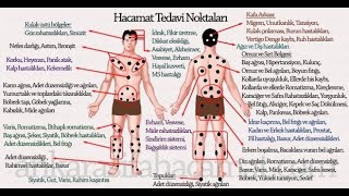 Hacamatın faydaları ve günleri - dinimiz islam