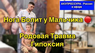 Нога Болит у Мальчика 🔴 Родовая Травма. Гипоксия «АКУПРЕССУРА - Россия» в эфире #шея #акупрессура