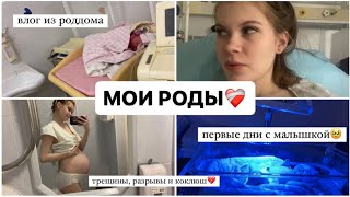 МОИ РОДЫ❤️‍🩹 Я РОДИЛА!🤰 ИСТОРИЯ МОИХ РОДОВ И ПЕРВЫЕ ДНИ С МАЛЫШКОЙ👶 ПЦ КОНЧАЛОВСКОГО🏥