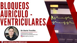 Taller de ECG en bloqueo auriculoventricular