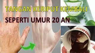 MERTUA KAGET!! TANGAN HITAM DEKIL JADI PUTIH PERMANEN TANPA SUNTIK PUTIH