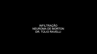 INTERVENÇÃO GUIADA PELO ULTRASSOM - INFILTRAÇÃO NO PÉ NEUROMA DE MORTON