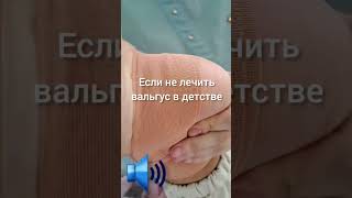 Вальгус важно вылечить   с 2-12 лет, спросите как? смотри в https://t.me/massageorto