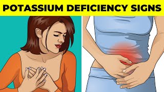 9 Signs Of A Potassium Deficiency You Should Never Ignore