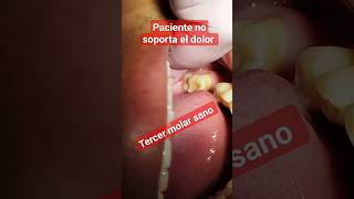 Te duele el diente y está completamente sano todavía no erupciona bien😭 Por qué #rootcanals #sigueme