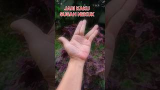 SEHAT TANPA OBAT : JARI KAKU DAN SAKIT #remix #tips #sehat #infosehat #bollywood #song #hindisong