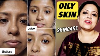 OILY SKINCARE | ACNE PIMPLES SKINCARE | Skincare for OILY Skin, ACNE Prone Skin @Saanch