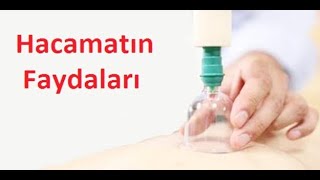 Hacamatın faydaları, günleri, bölgeleri, dikkat edilmesi gerekenler Dr Aidin Salih