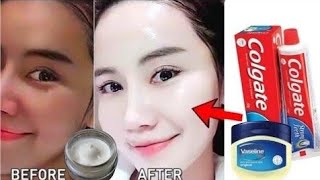 Applied Toothpaste And Vaseline On My Face At Night For 5 Minutes, Watch What Happened After