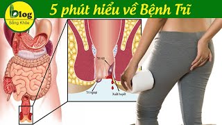 Bệnh Trĩ - nguyên nhân và cách điều trị bệnh