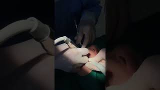 Bác sĩ phẩu thuật nhổ răng khôn tại Nha khoa sài gòn new dental