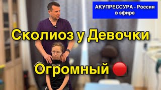 Сколиоз у Девочки Огромный 🔴 Искривление Позвоночника «АКУПРЕССУРА–Россия» #шея #сколиоз#акупрессура