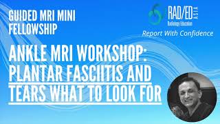 MRI Online Review Learn MSK MRI Radiology - Plantar Fascia Tears and Plantar Fasciitis MRI