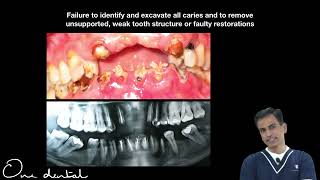 Procedural errors during access opening and their management