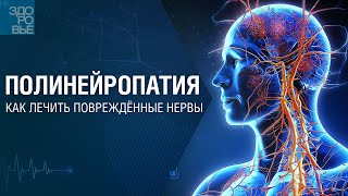 Полинейропатия. Как лечить повреждённые нервы. На здоровье 22.06.2024