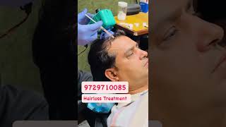 Hair fall | PRP Treatment for Hairloss | Hair care #shorts #prp #hair #skincare