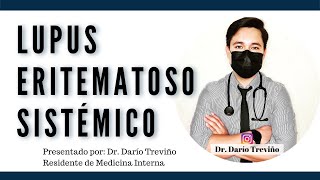 Lupus Eritematoso Generalizado #ENARM | 🩺Dr. Treviño