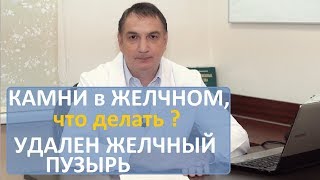 Камни в желчном пузыре, симптомы, лечение. Удален желчный - последствия операции, и что делать.