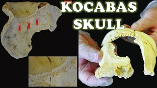 Kocabas Skull | The Homo Erectus From Turkey