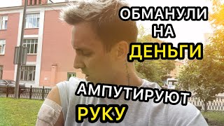 Что с рукой ? Обманули на деньги