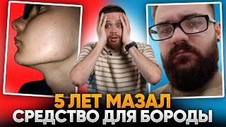 5 ЛЕТ со средством для роста бороды / САМЫЙ ИНФОРМАТИВНЫЙ ВЫПУСК!