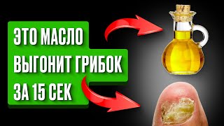 Как я навсегда избавилась от ГРИБКА НОГТЕЙ простым… за 15 сек? Это МАСЛО есть у каждого