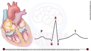 Mi transmTaller de ECG