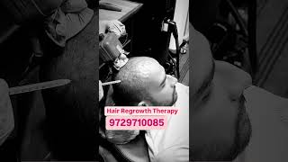 PRP Treatment for Hair loss |Prp therapy for hair Growth #shorts #prp #hair #youtubeshorts