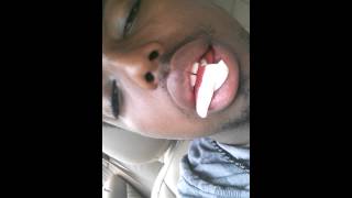 $hawnWhyte after the Dentist