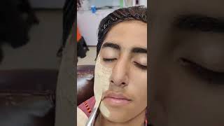 Skin Treatment Challenge 24 Hours 🔥#shortvideo #trending #youtube