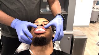 MILLION DOLLAR SMILE ON THE WAY!!! ( MY FIRST TIME GETTING DENTAL SURGERY )