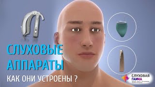 Что такое слуховой аппарат. Как он работает? Какие стили бывают?