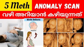 Anomaly scan Malayalam | 5 Month Scanning during Pregnancy | Second Trimester Scan