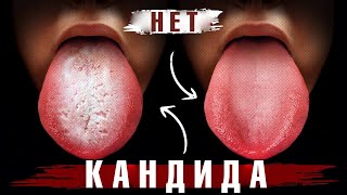 Начните делать это сейчас – и избавитесь от кандидоза навсегда!👍