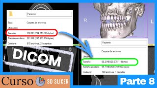 💾 Bases de datos DICOM - ¡Ahorra espacio en disco!