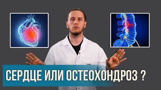 Боль в грудной клетке: СЕРДЦЕ или ОСТЕОХОНДРОЗ? | Раскладываем все по полочкам | Доктор Епифанов