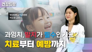 [KNN건강튜브] 과잉치 치료법과 예방법까지 한 번에!