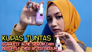 KUPAS TUNTAS SERUM SCARLETT WHITENING. CARA PAKAI + FULL REVIEW