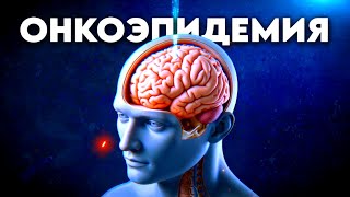 Кибернож, протонный синхротрон и другие способы лечения одной из главных причин смертности людей