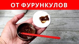 ХОЗЯЙСТВЕННОЕ МЫЛО от фурункулов