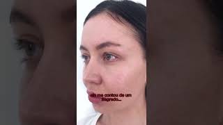 Desperte sua Beleza com Tratamentos de Rejuvenescimento Facial!"